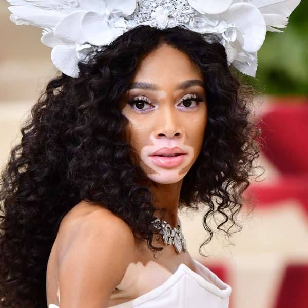 Winnie Harlow